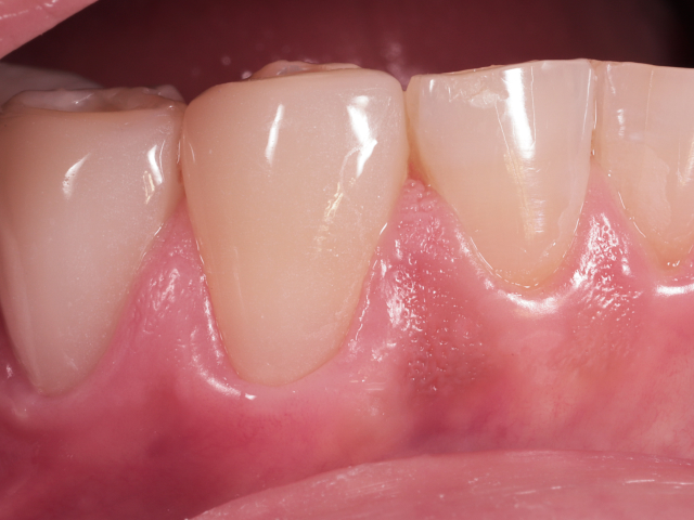 Ceramel-process-img3