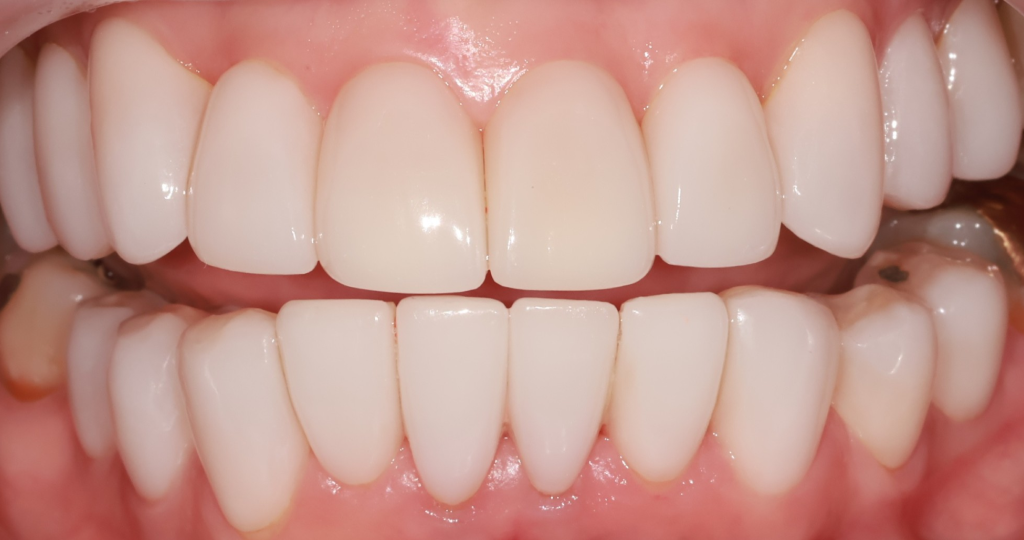 Clara AI & Ceramel 完了